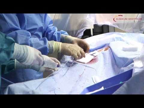 Invasive Kardiologie am Klinikum Westfalen