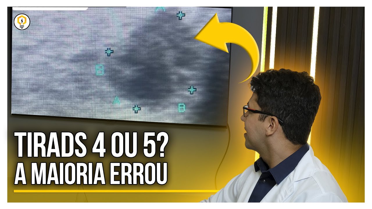 Como Diferenciar TIRADS 4 do TIRADS 5 no Ultrassom?