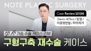 [가슴리뷰] 구형구축 l 두번째 재수술 l 피막 제거 l 사이즈 키우기 l 보형물 제거