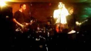 X-Ray Eyes by The Scratch