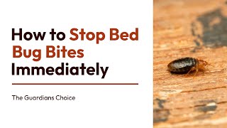 4 Ways to Stop Bed Bug Bites Immediately | How to Stop Bed Bug Bites Immediately
