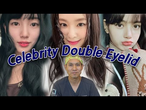 Our Complete Review of Korean Celebrity Double Eyelids #plasticsurgery