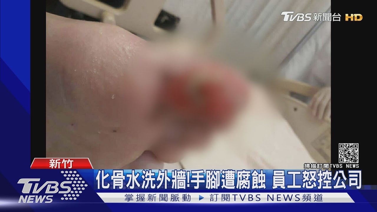 化骨水洗外牆！手腳遭腐蝕　員工怒控公司