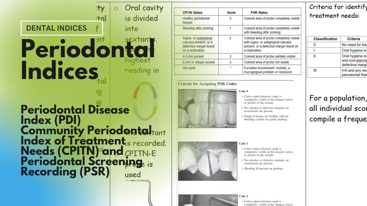 What are periodontal indices? EN General