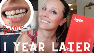 BYTE ALIGNERS REVIEW | 1 year update + byte and pregnancy