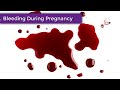 10 Signs of an Unhealthy Fetus | Symptoms of Unhealthy Baby During Pregnancy