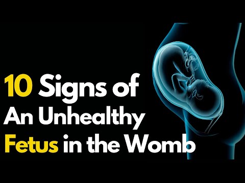 10 Signs of an Unhealthy Fetus | Symptoms of Unhealthy Baby During Pregnancy