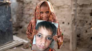 Smile Train & Haleon: Free Cleft Surgery and Care