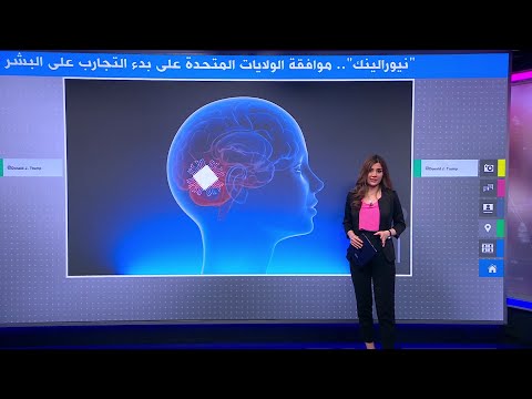 "نيورالينك".. تقنية تستخدم شريحة المخ تدخل مرحلة التجارب على البشر