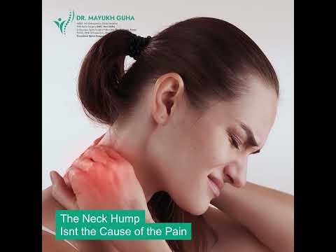 Mayukh Guha Postural Kyphosis