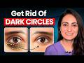 How To Remove Dark Circles Best Creams Dermatologist Suggests
