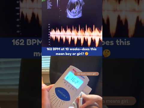 He or She? Fetal Heartbeat of 162bpm at 10 Weeks 🥰 Boy or Girl? Fetal Gender on Ultrasound