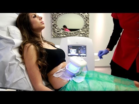 Innowacyjna kriolipoliza ZLipo w synergii z falą uderzeniową ZWavePro