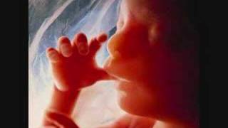 NAS ~ "FETUS"