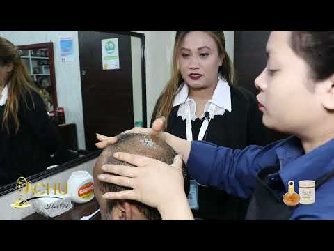 How to Use Yachu Hair Oil For Baldness