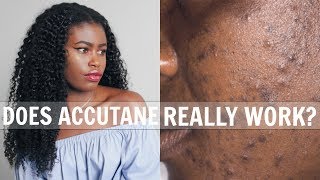 Accutane Cost Bcbs