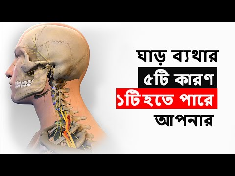 ঘাড়ে ব্যথার কারণ | ঘাড়ে ব্যথা কেন হয় | Neck Pain Bangla | ghar bethar karon