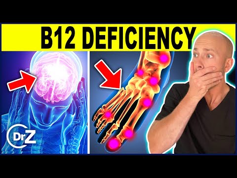 10 Warning Signs That You Have A B12 Deficiency