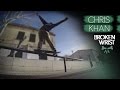 Chris Khan Broken Wrist Video Part