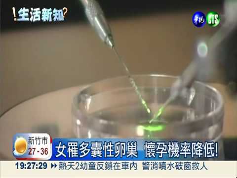 患多囊性卵巢! 糖尿病風險高3倍