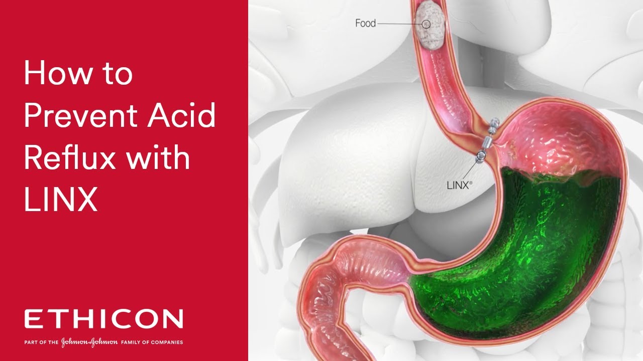 Pablo Marín Pérez-5