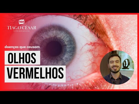 Doenças que causam Olhos Vermelhos | Dr. Tiago César
