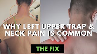 The Curious & Common Case of Left Upper Trap and Neck Tightness - The Fix