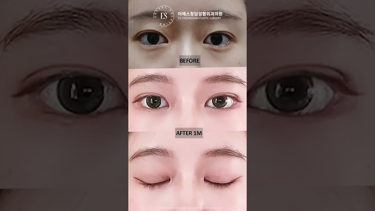 이에스 유튜브