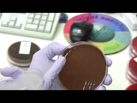 Urogenital cultures of the Cervix