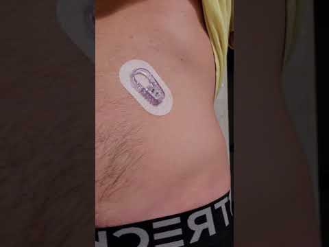 Dexcom G6 in ME BELLY