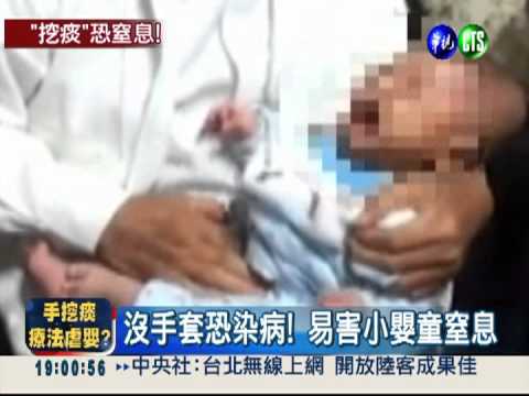 徒手"抓痰" 輕則感染.重則窒息