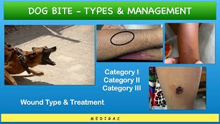 Dog bite - Category 1,2,3 || Wound types and Management/Treatment