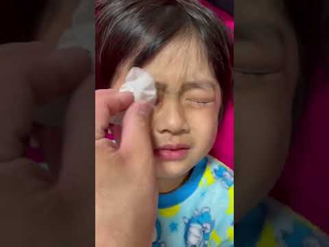 アレルギーのみなくん😭　目薬出来るかな⁉️ 4歳　まりちゃんいずちゃんチャンネル　#shorts