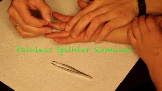 How To: Painless Splinter Removal!