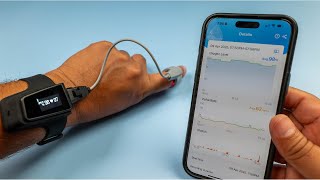 Wellue Checkme O2: The Future of Home Health Monitoring