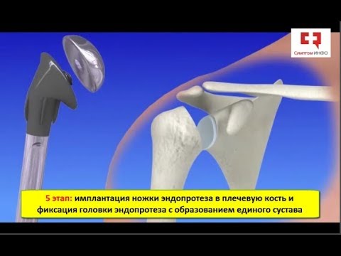 Суставы грудного отдела позвоночника по форме Мазь от болей в позвоночнике и суставах