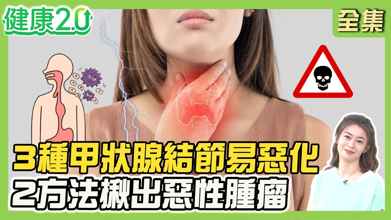 本土歌手「長3顆甲狀腺結節」！補3營養素　專家推2抗癌飲食法