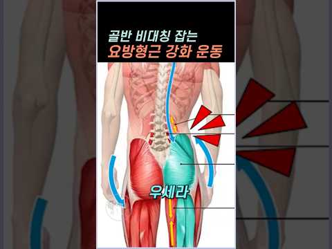 요추 측만 교정 3동작 루틴 미리보기
