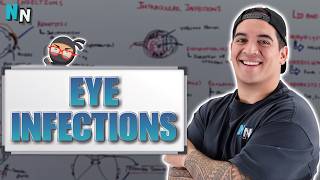 Eye Infections (Updated) | Clinical Medicine