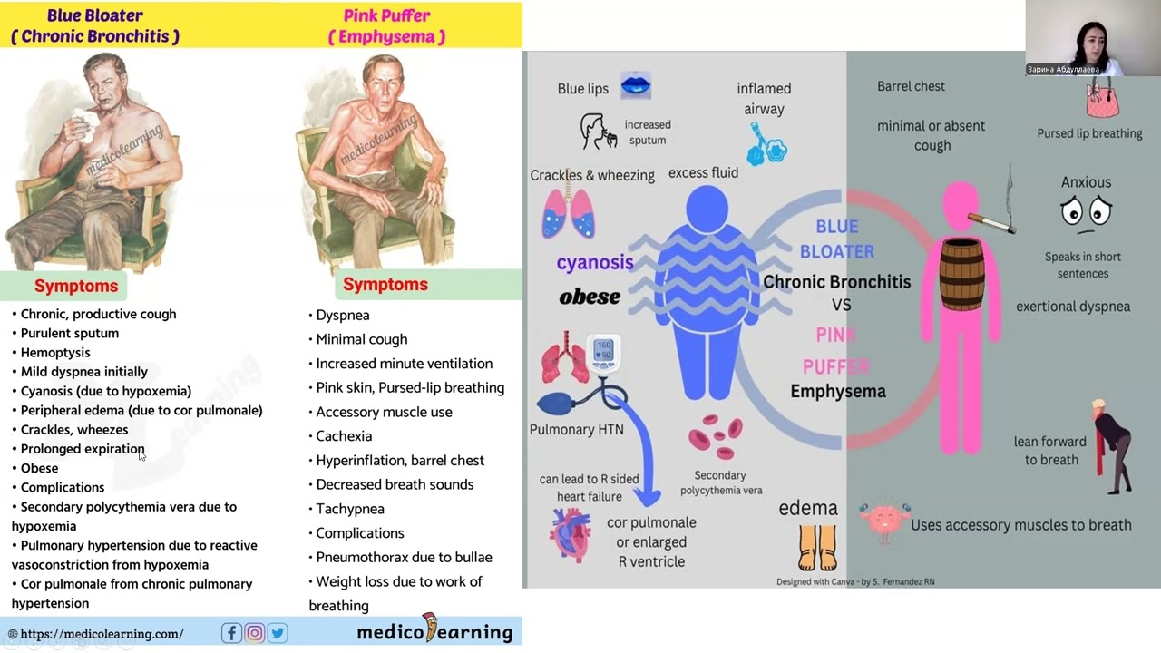 Obstructive lung diseases