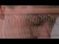 francis lung - back one day 