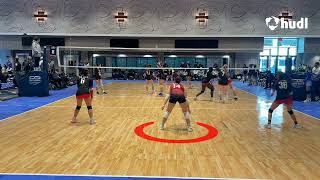 Defense and serve recieve