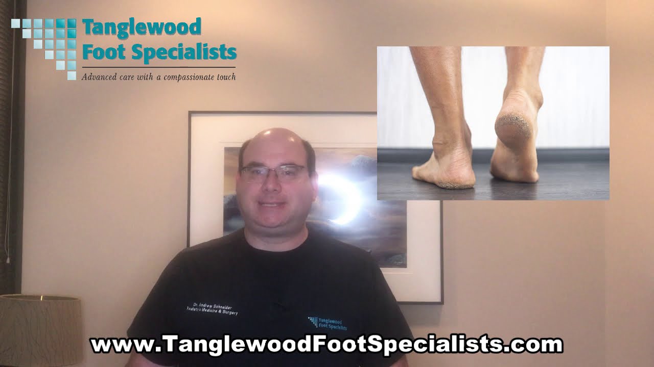 How to Manage Dry, Cracked Heels and Feet