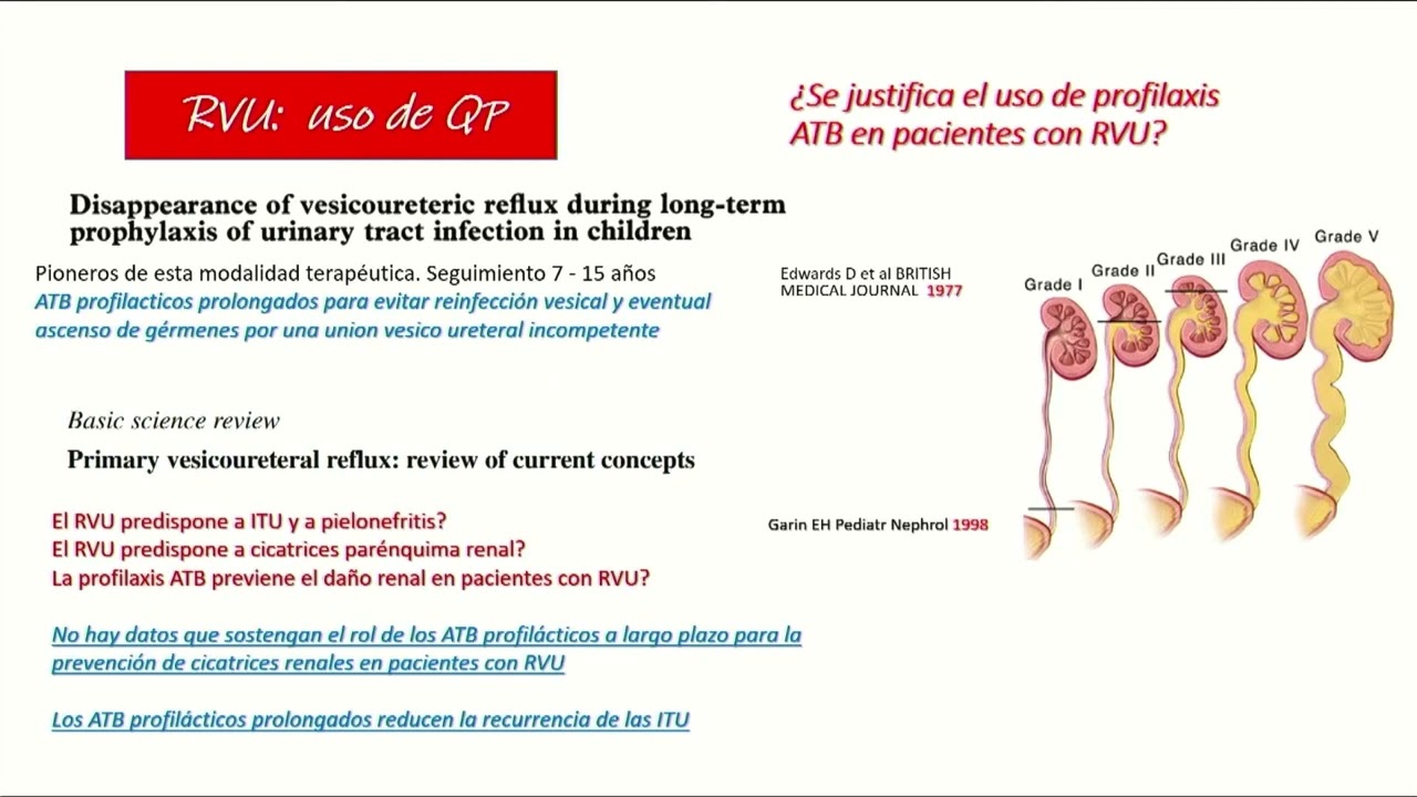 Actuales recomendaciones de profilaxis antibiótica en ITU RVU y CAKUT - Dra. Margarita Halty (Uruguay)