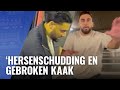 Man bewusteloos geslagen en geschopt in parkeergarage bij Leidseplein