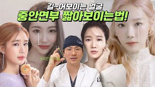 얼굴이 길어 보이는 이유!? 양악말고 중안면부 줄이는 치트키! #중안면부