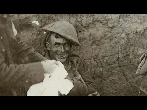 This Is What Shell Shock Looks Like… ☠️