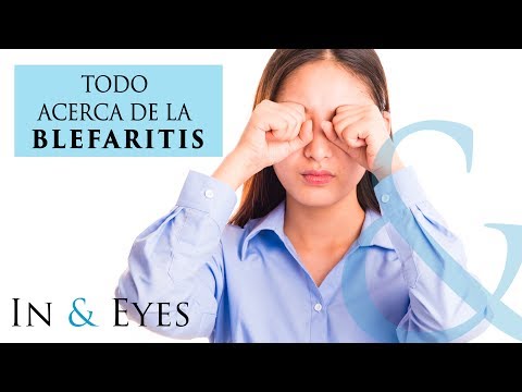 TODO ACERCA DE LA BLEFARITIS