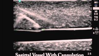 Product video: CAE Blue Phantom Ultrasound Training Blocks