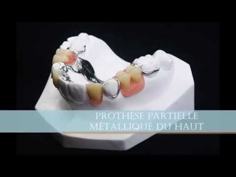 comment financer implants dentaires